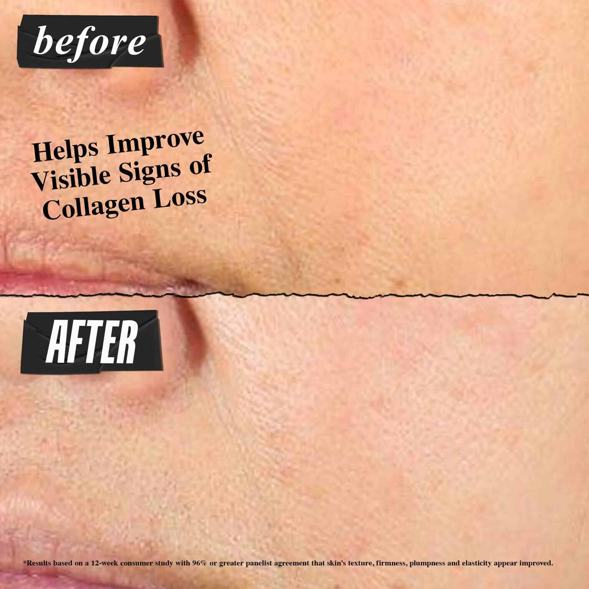 Előtte-utana foto: a Kiehl's Super Multi-Corrective Cream segit javitani a kollagenvesztes lathato jeleit