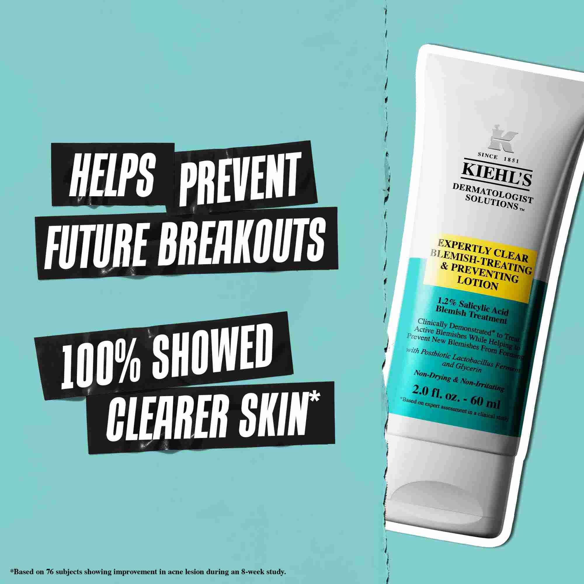 Egy Expertly Clear Blemish-Treating & Preventing Lotion tubus kek hatter előtt, a szoveg jelentese: „Segit megelőzni a jovőbeni pattanasokat” es „100% tisztabb bőrt mutatott”.