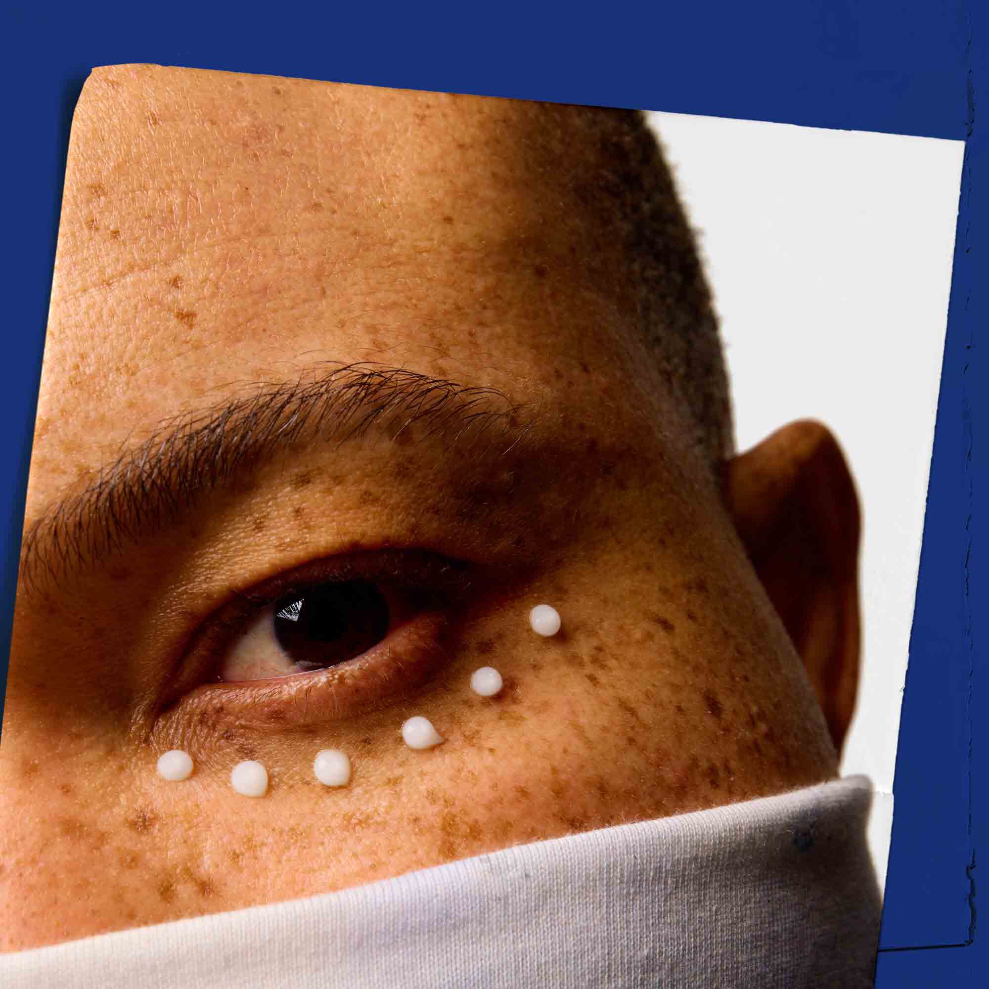 A szemkornyek bőrenek kozelkepe Facial Fuel Eye Fuel pottyokkel.