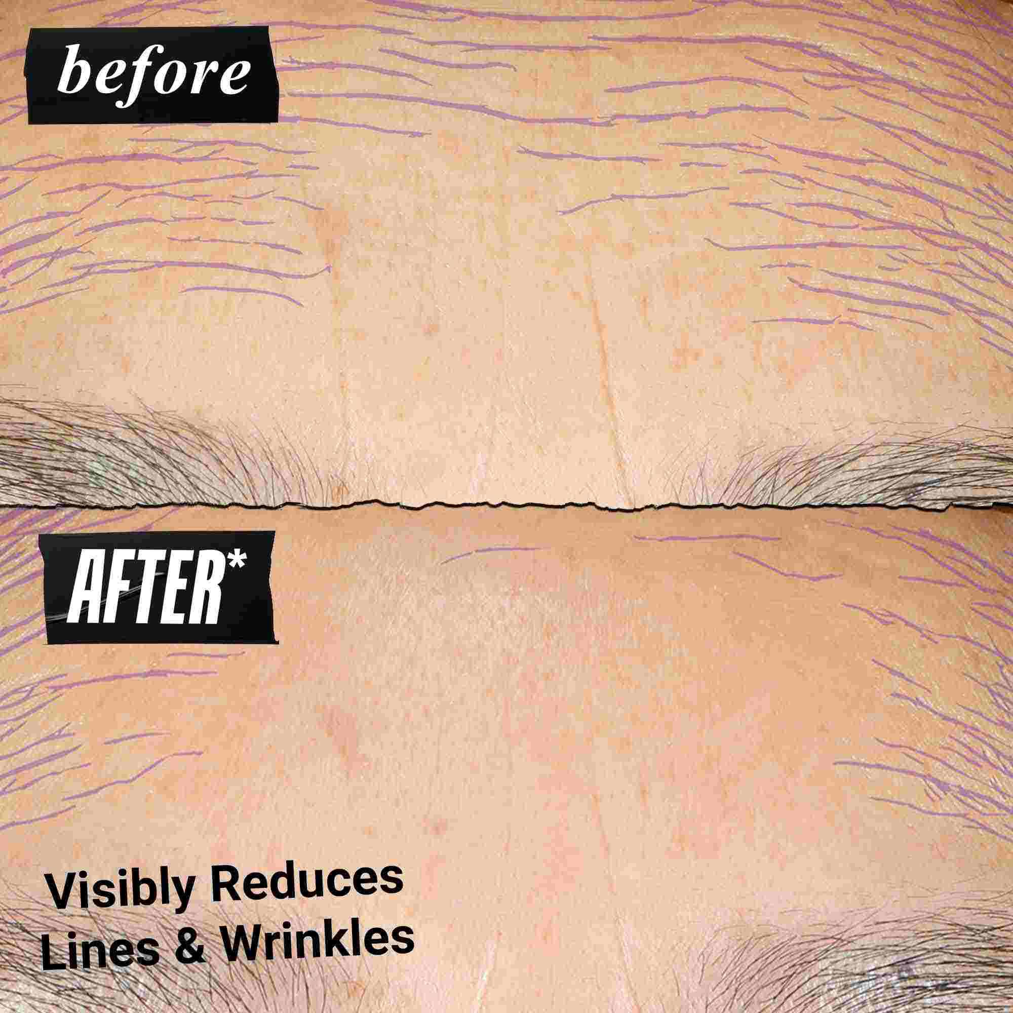 Előtte-utana foto – a Kiehl's Retinol Skin Renewing Daily Microdose segit javitani a bőrtonust es a texturat