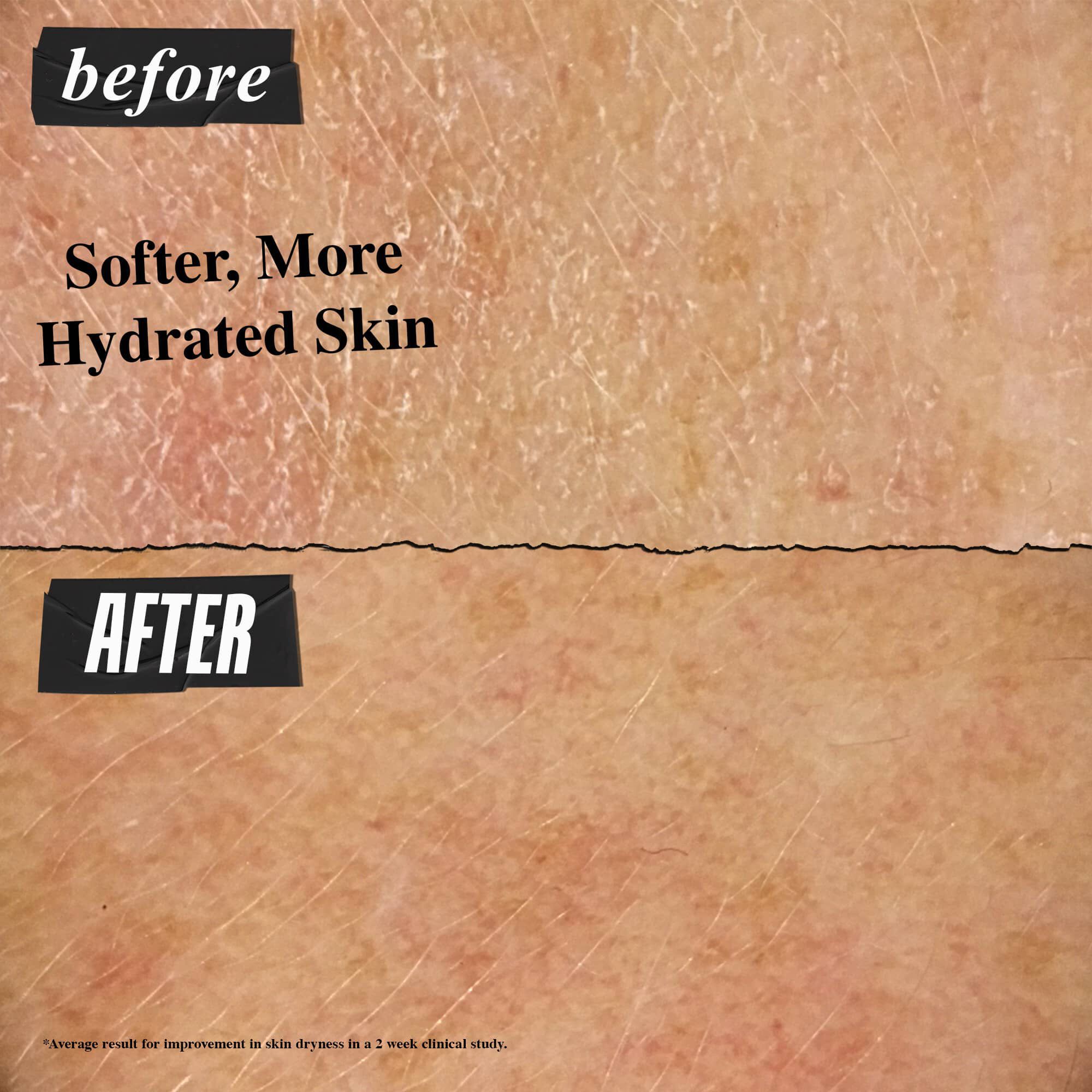 Előtte-utana foto – az Ultra Facial Cream eredmenye puhabb, hidrataltabb bőr