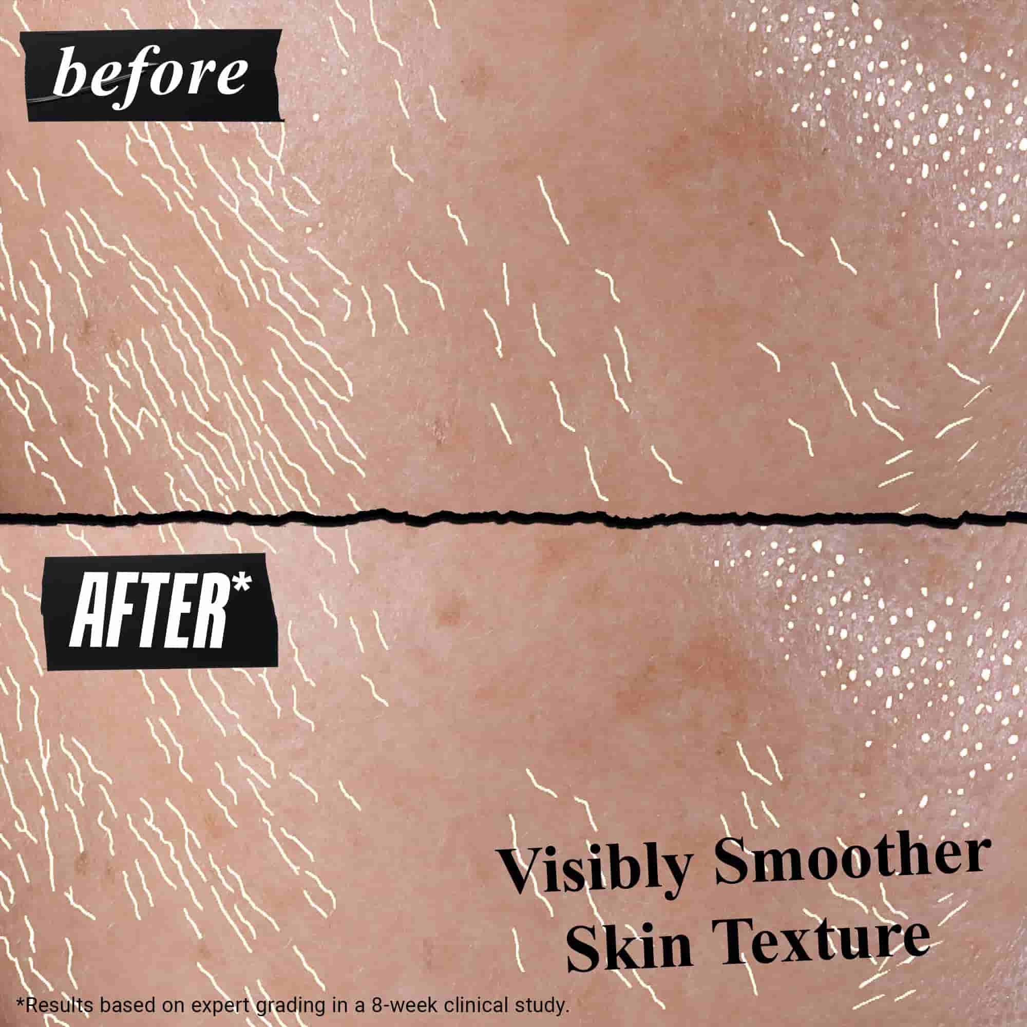 Better Screen UV Serum előtte es utana eredmenyek a bőron