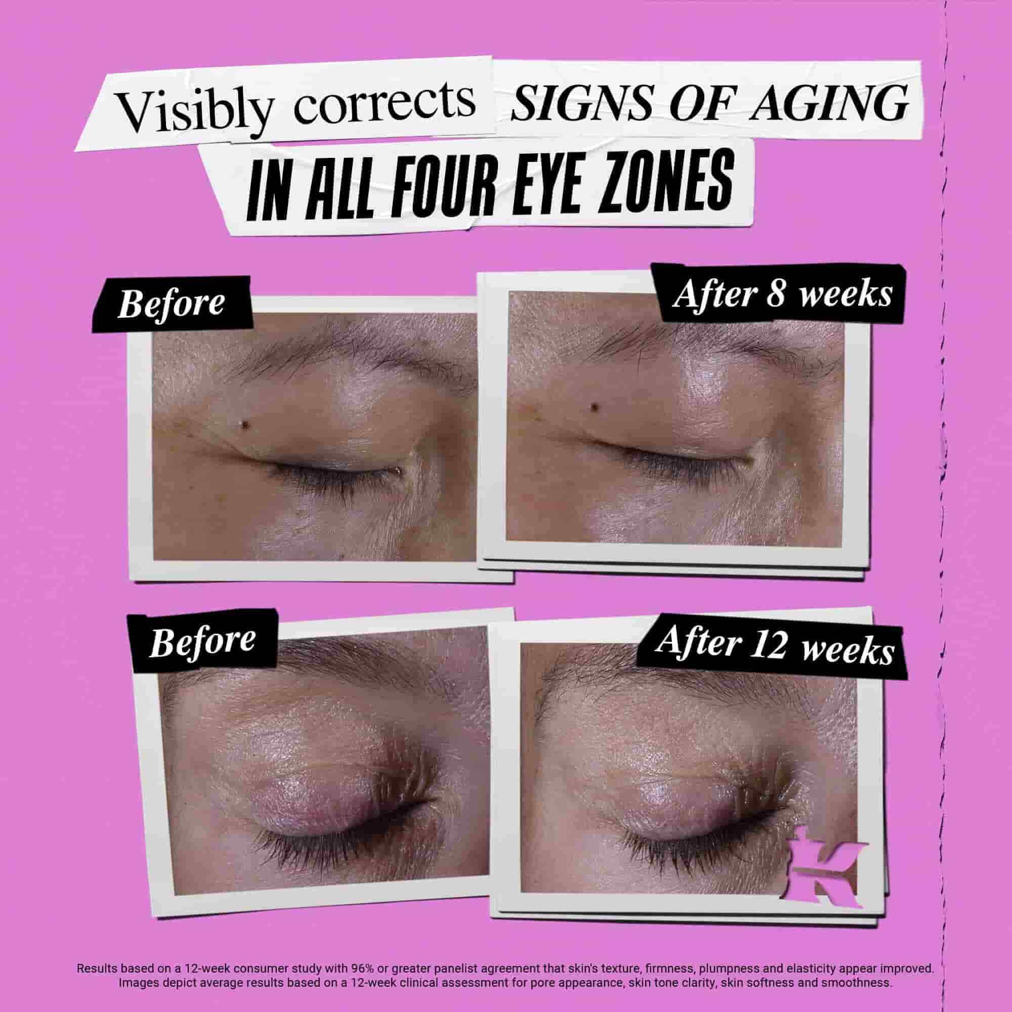 Előtte-utana foto a Kiehl's Super Multi-Corrective Eye Zone Treatment oregedes jeleit korrigalo hatasarol