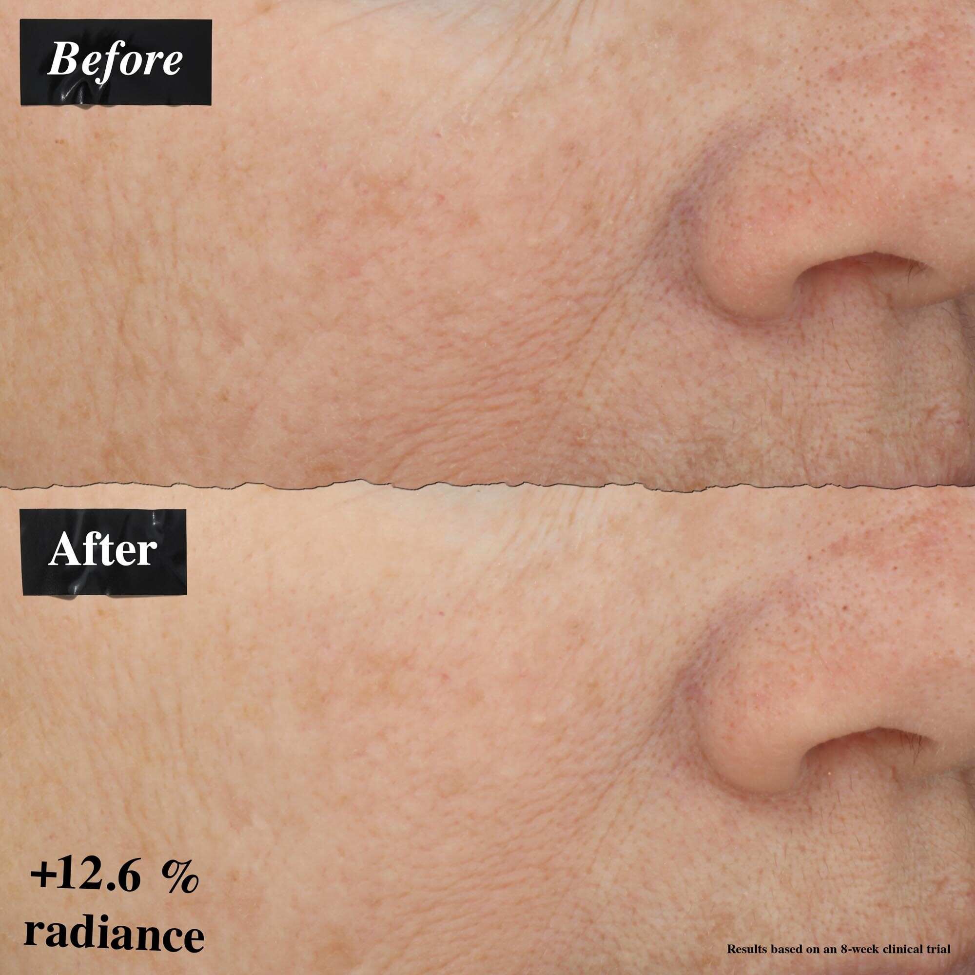 Előtte-utana keposszehasonlitas, amely a bőrpir javulasat mutatja a Powerful-Strength Line-Reducing Concentrate hasznalata utan.