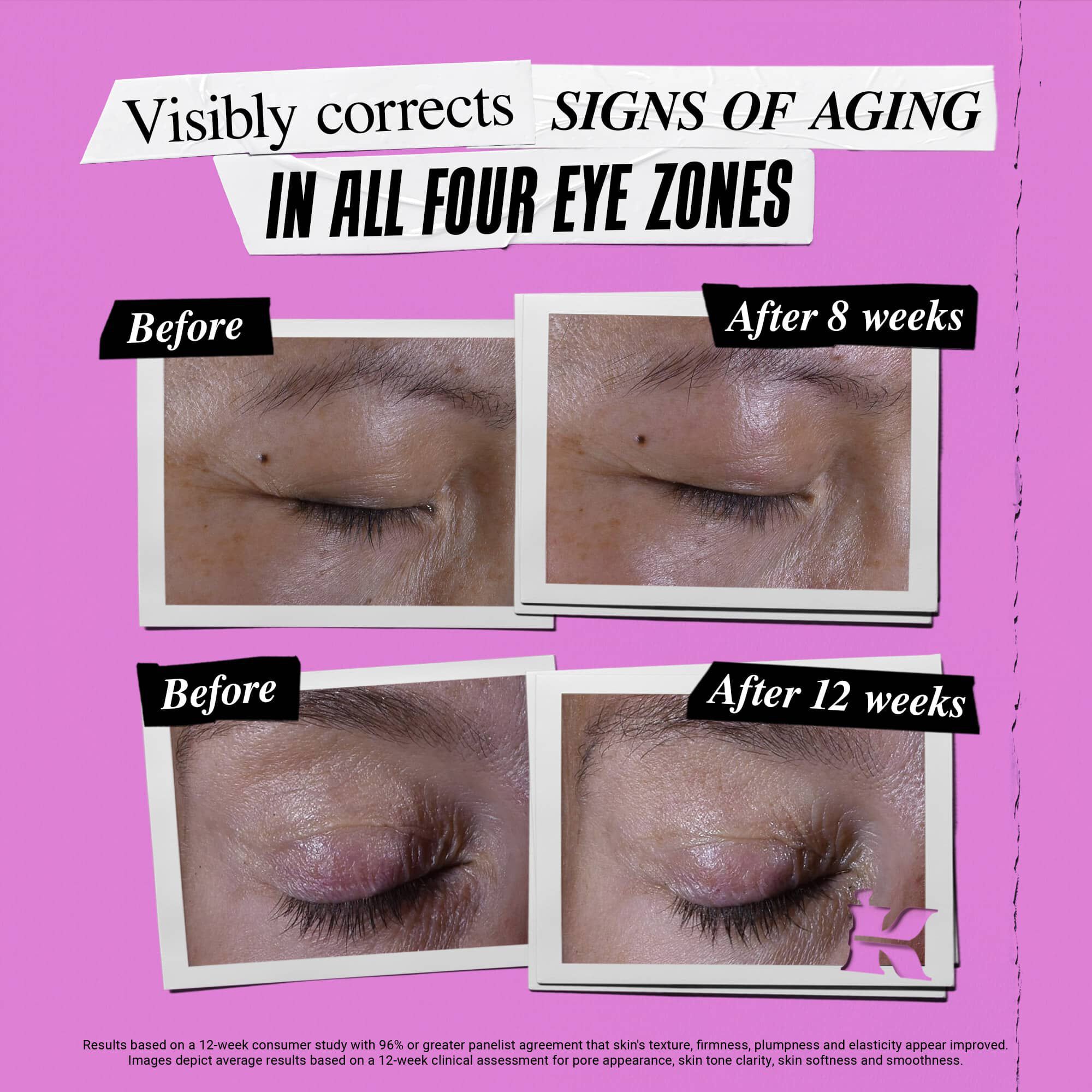Előtte-utana foto a Kiehl's Super Multi-Corrective Eye Zone Treatment oregedes jeleit korrigalo hatasarol