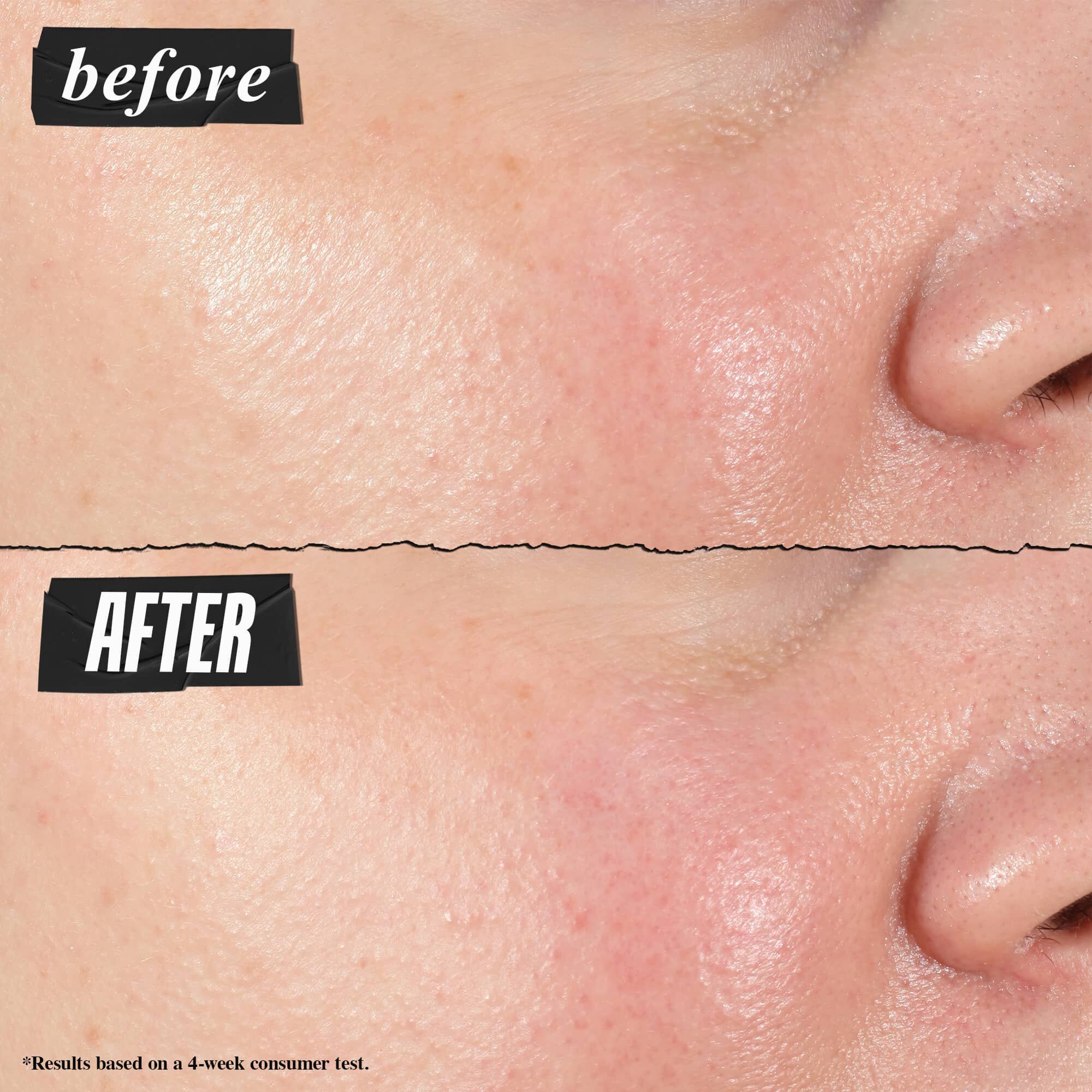 Előtte-utana foto – a Kiehl's Hydro Plumping Serum Concentrate lathatoan csokkenti a porusokat