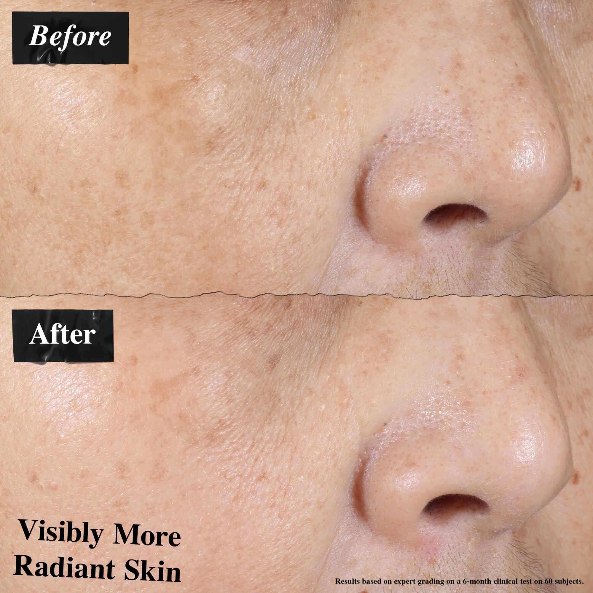 Előtte-utana osszehasonlitas, amely lathatoan csokkent bőrpirt mutat az Ultra-Light Daily UV Defense hasznalata utan.