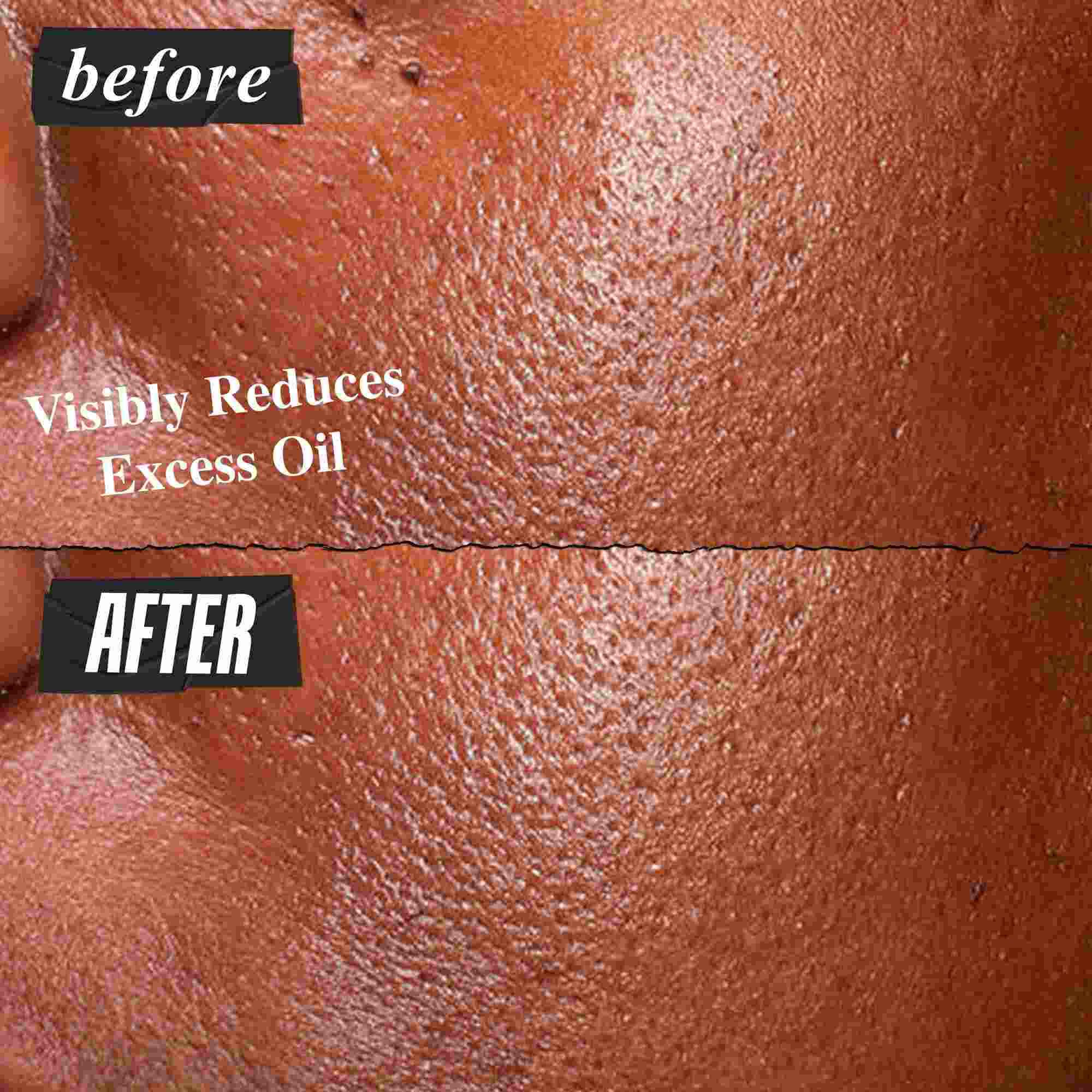 Előtte-utana foto a Kiehl's Ultra Pure High-Potency Serumrol, amint lathatoan csokkenti a felesleges faggyut