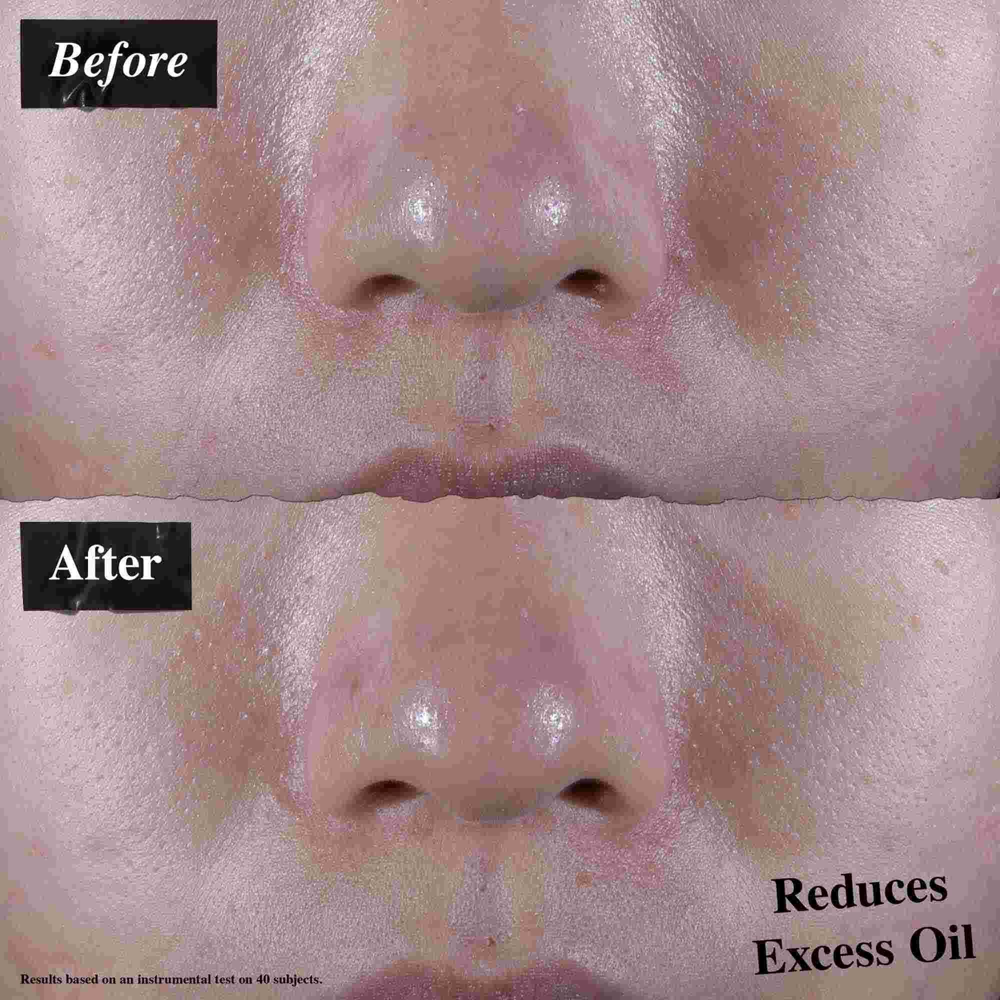 Előtte-utana osszehasonlitas, amely csokkent felesleges olajat mutat az Ultra Facial Oil-Free Gel Cream hasznalata utan.