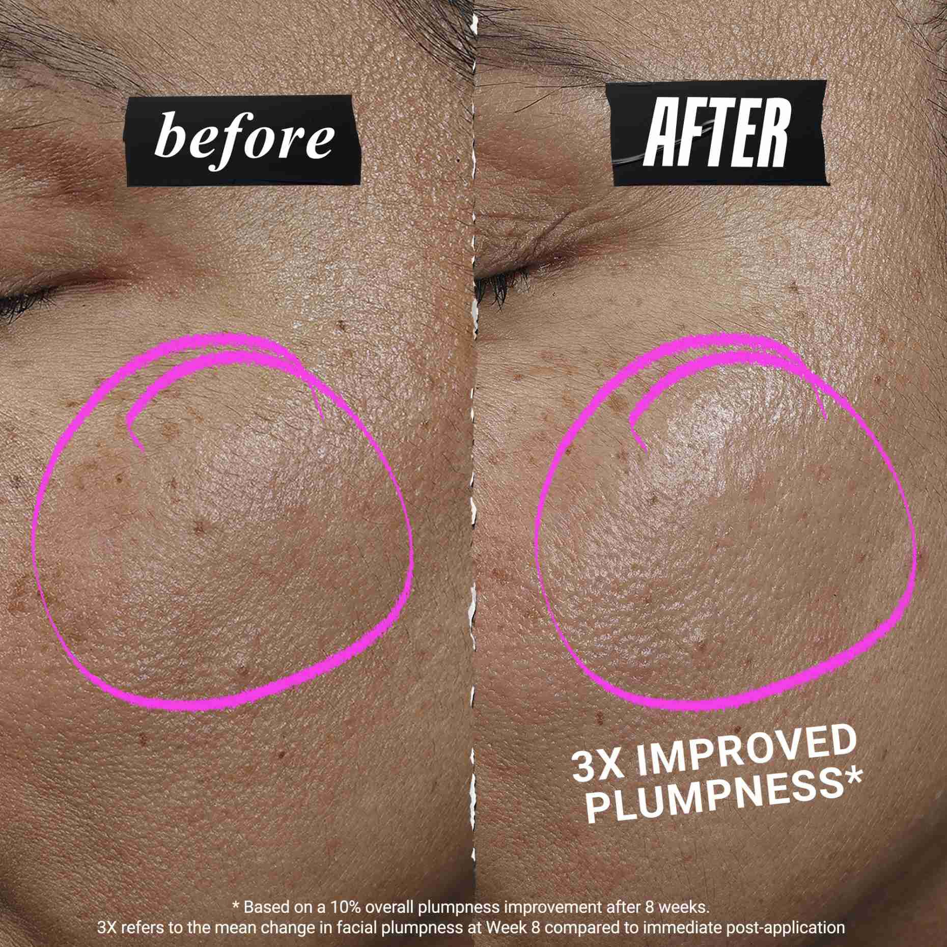 1cc* CollaShot Plump szerum, kollagen arcszerum felemelt, teltebb bőrhoz