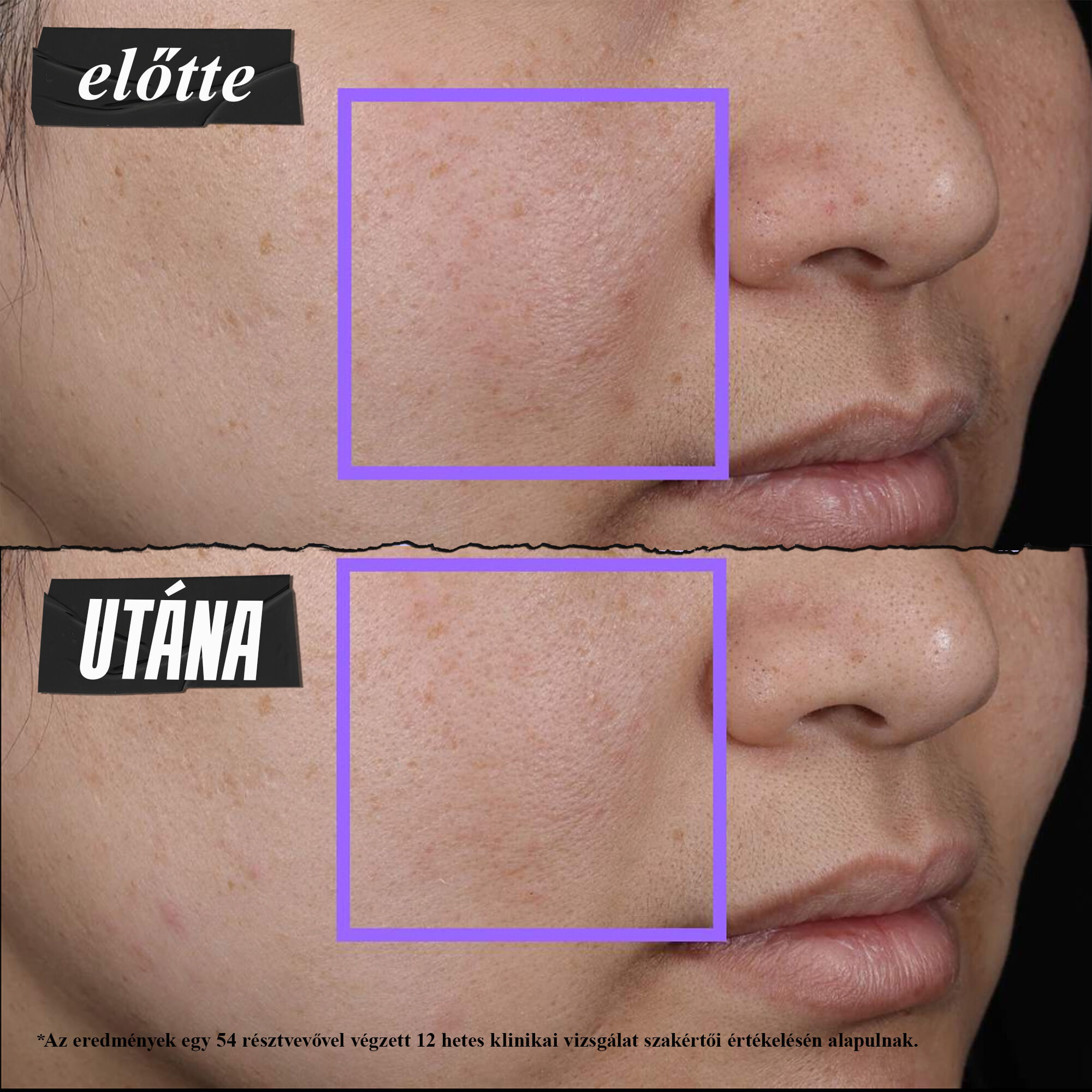 Clearly Corrective™ Clarity-Activating Soothing Emulsion